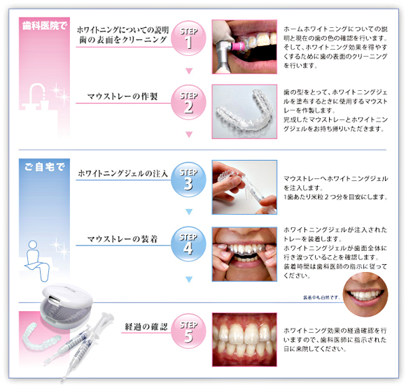 当院のホームホワイトニングの流れ